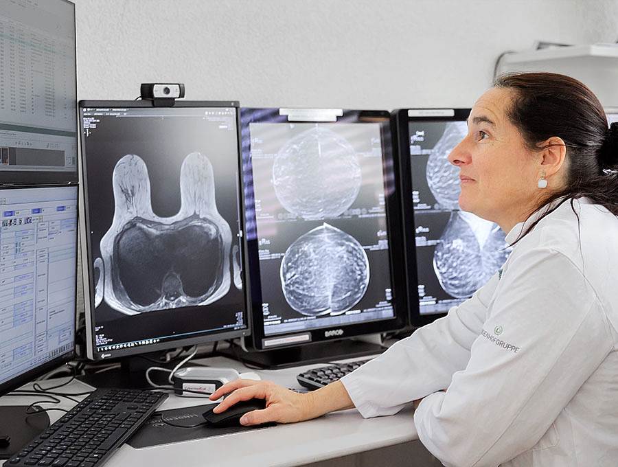 Brustradiologie Engeried