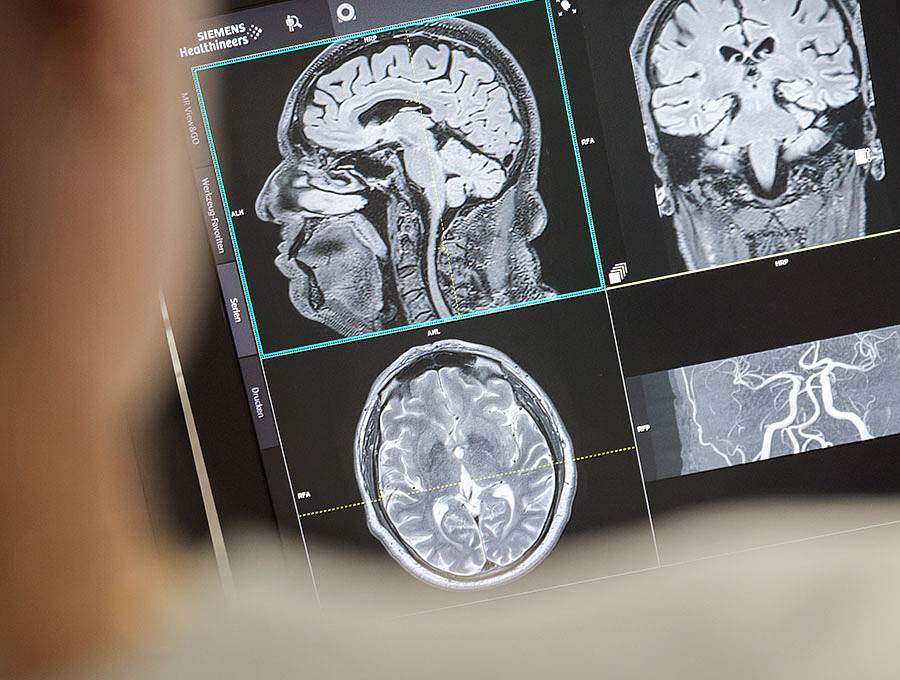 Neuroradiologie Campusradiologie