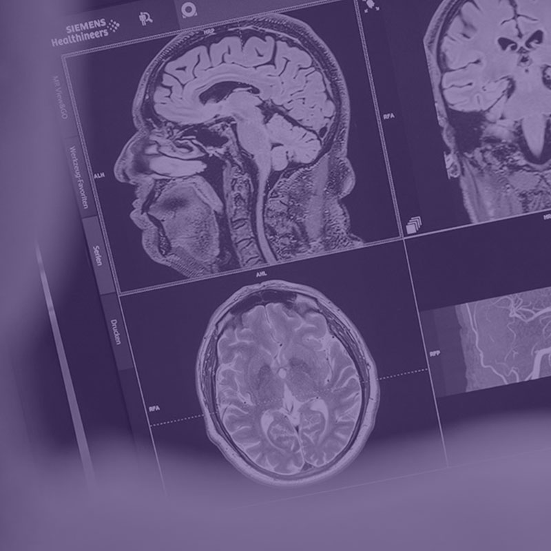Neuroradiologie