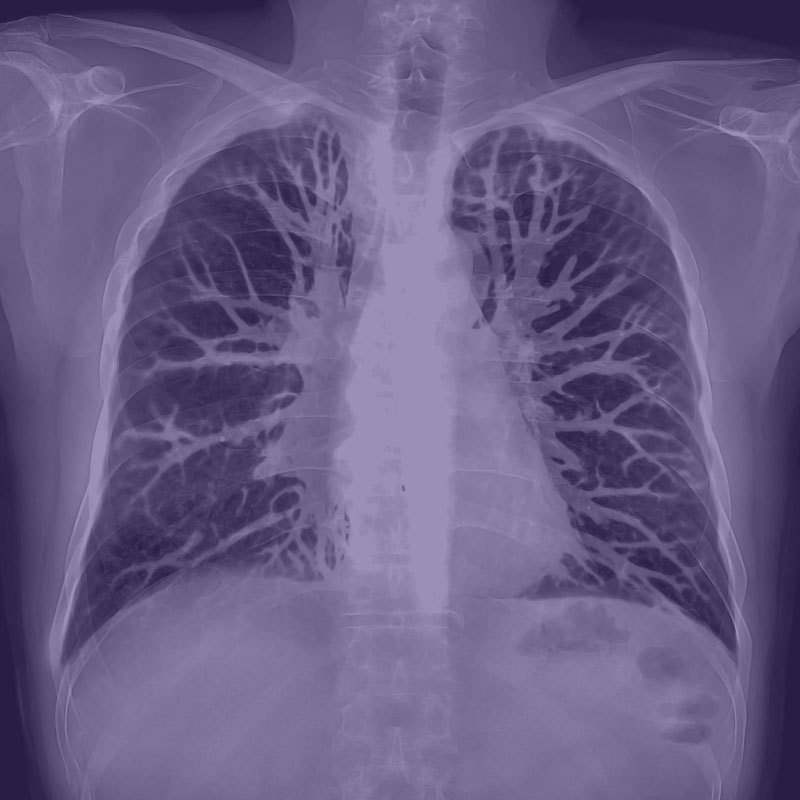Thoraxradiologie